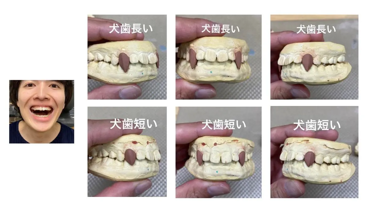 ドラキュラ_牙のサイズ